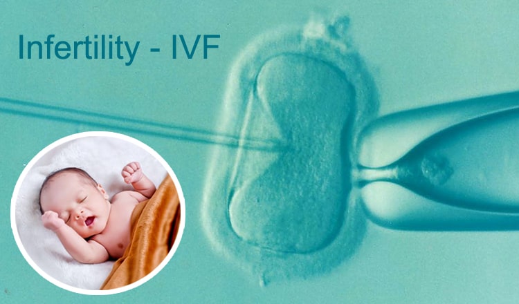 Infertility – IVF Procedure